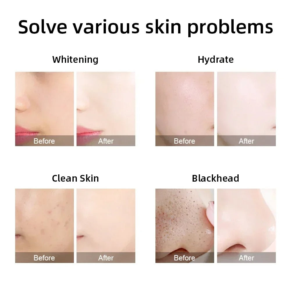 Professional HydraFacial Machine